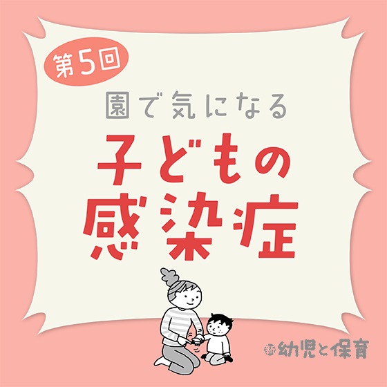 第5回「水痘」~医師に聞く 園で気になる子どもの感染症~ 第5回「水痘」~医師に聞く 園で気になる子どもの感染症~